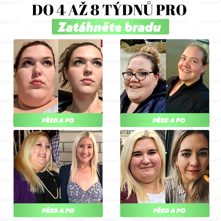 🏆Oficiální obchod | BuildLeaf® GLP-1 20-v-1 Slim & Zdraví orální roztok 💧 (1× denně, výsledky za 7 dní). Obsahuje 100 mld. CFU probiotik ✅ Podporuje hubnutí, zdraví srdce, trávení i energii.