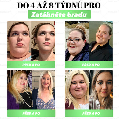 🏆Oficiální obchod | BuildLeaf® GLP-1 20-v-1 Slim & Zdraví orální roztok 💧 (1× denně, výsledky za 7 dní). Obsahuje 100 mld. CFU probiotik ✅ Podporuje hubnutí, zdraví srdce, trávení i energii.