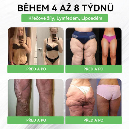 🧑‍⚕️🧑‍⚕️DOOEKA® GLP-1 8 v 1 Fit & Vital perorální roztok – jednou denně, viditelné změny za 7 dní / při obezitě, kardiovaskulárním zdraví, cukrovce, spánkové apnoi, zdraví střev, kloubních potížích a mnoha dalších stavech